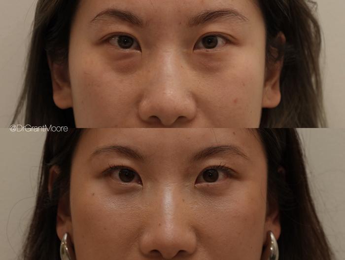 Dr. Grant Moore, MD result — Scottsdale, AZ