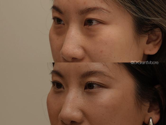 Dr. Grant Moore, MD result — Scottsdale, AZ