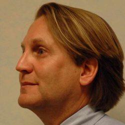 Rhinoplasty after at Plastic Surgeon Cleveland: Dr. Paul Vanek in Concord, OH