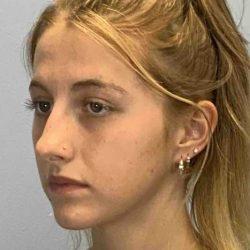 Rhinoplasty before at Plastic Surgeon Cleveland: Dr. Paul Vanek in Concord, OH