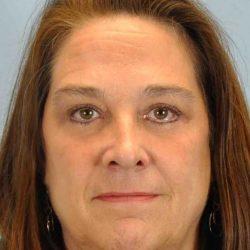 Blepharoplasty after at Plastic Surgeon Cleveland: Dr. Paul Vanek in Concord, OH