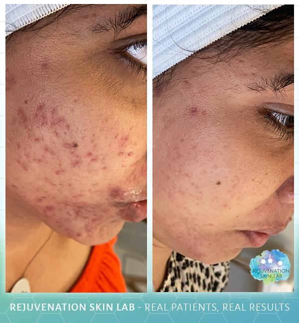 Rejuvenation Skin Lab result — Richmond, VA