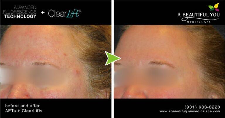 A Beautiful You Medical Spa result — Memphis, TN