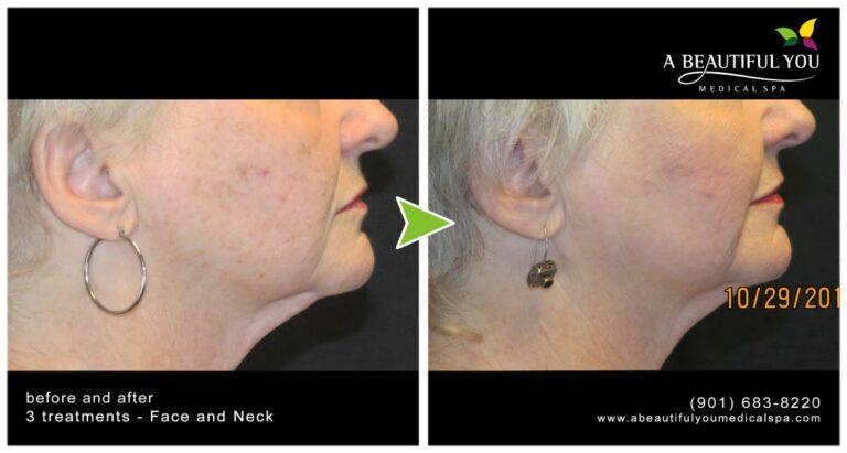 A Beautiful You Medical Spa result — Memphis, TN