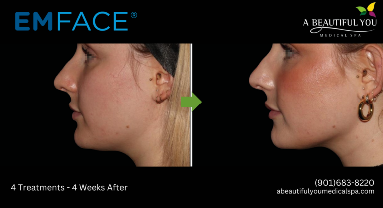 A Beautiful You Medical Spa result — Memphis, TN