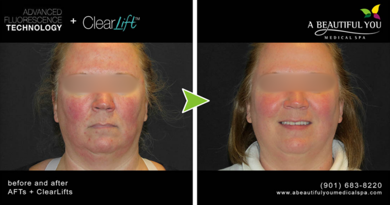 A Beautiful You Medical Spa result — Memphis, TN