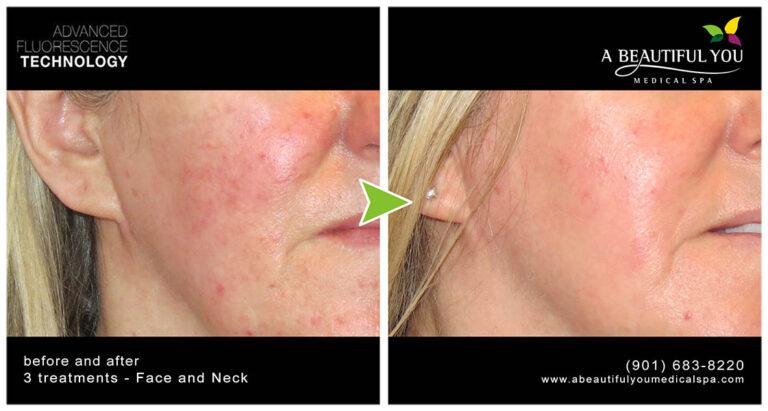 A Beautiful You Medical Spa result — Memphis, TN