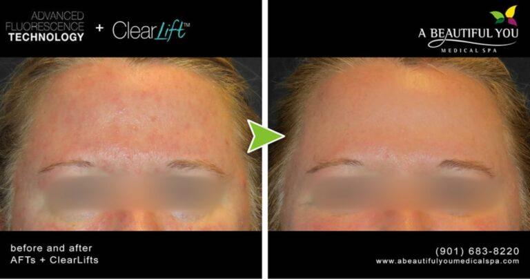 A Beautiful You Medical Spa result — Memphis, TN