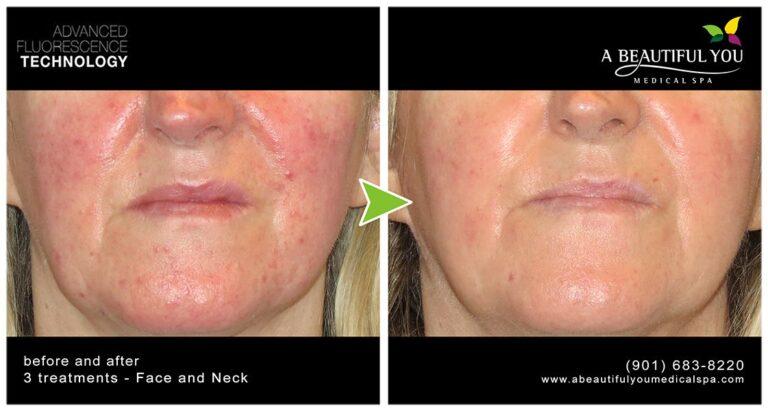 A Beautiful You Medical Spa result — Memphis, TN