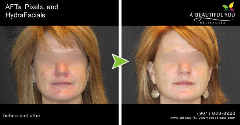 A Beautiful You Medical Spa result — Memphis, TN