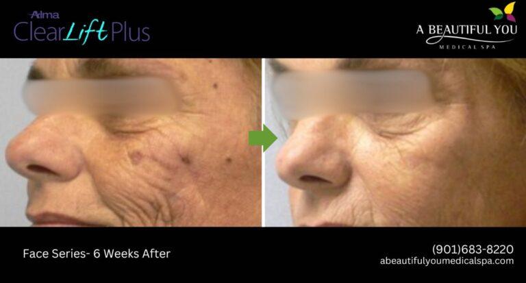 A Beautiful You Medical Spa result — Memphis, TN