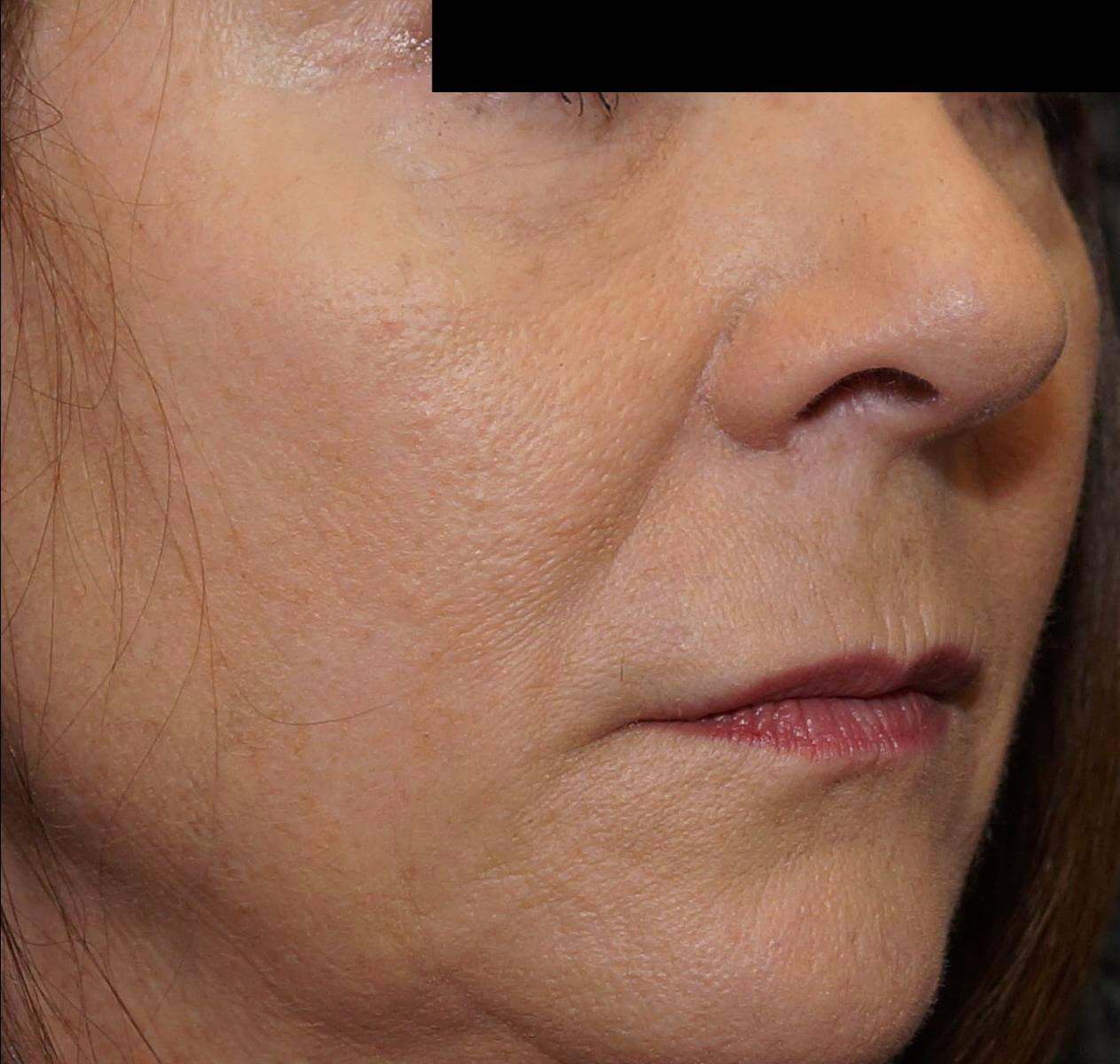 Mimi Lee M.D. PA after — Little Rock, AR