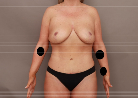 O'Neill Plastic Surgery after — Charleston, SC