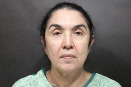 Deep Plane Facelift before at Korman Plastic Surgery & Wunderbar Medspa in San Jose, CA