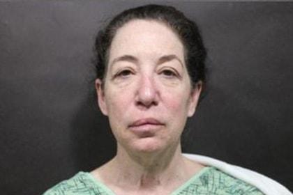 Deep Plane Facelift before at Korman Plastic Surgery & Wunderbar Medspa in San Jose, CA