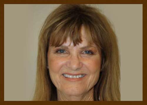 Diaco Institute of Plastic Surgery eyelid lift after — Tampa, FL