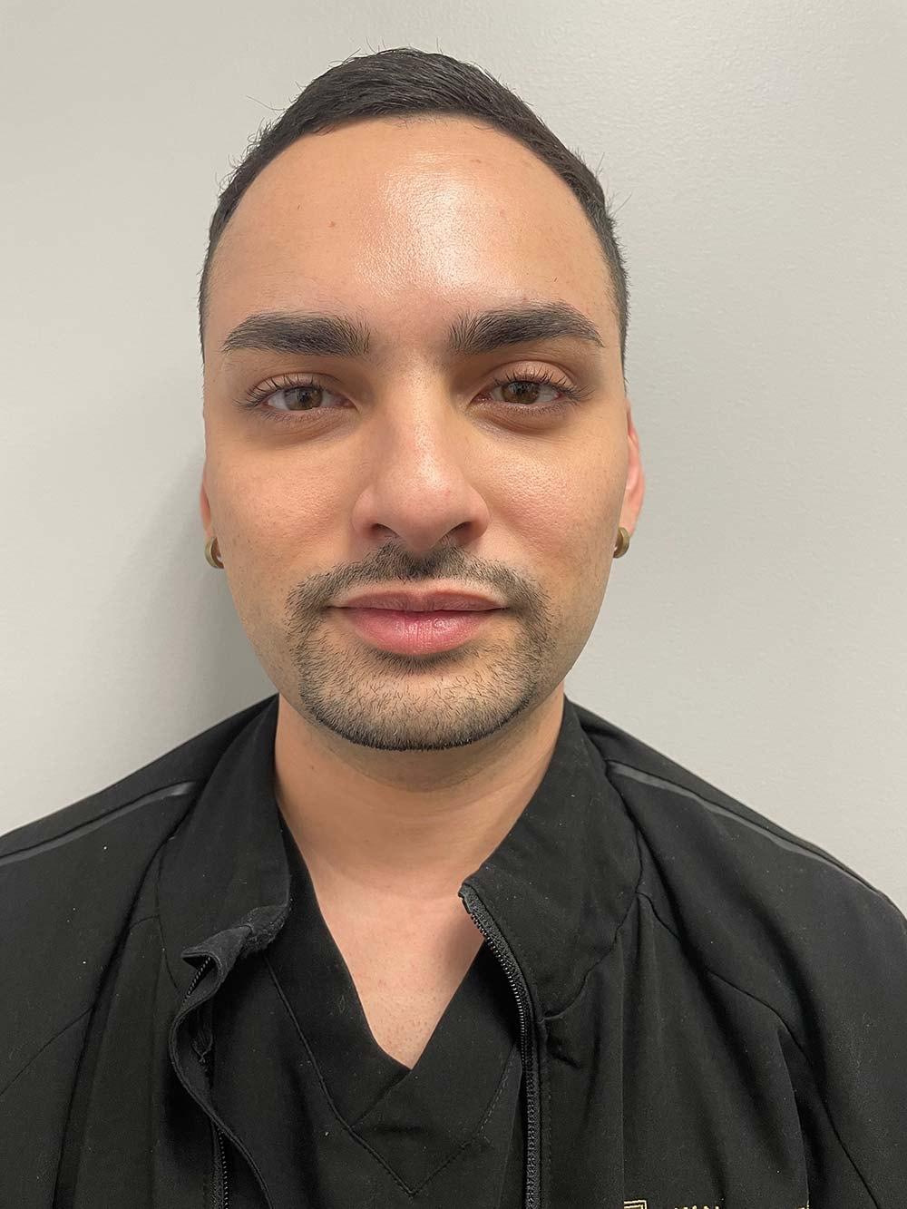 Skin Perfect Medical Aesthetics botox after — Costa Mesa, CA