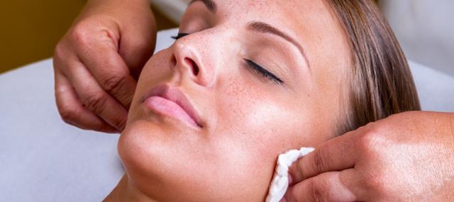 Chemical Peel result at Laura Trapp Aesthetics in Omaha, NE