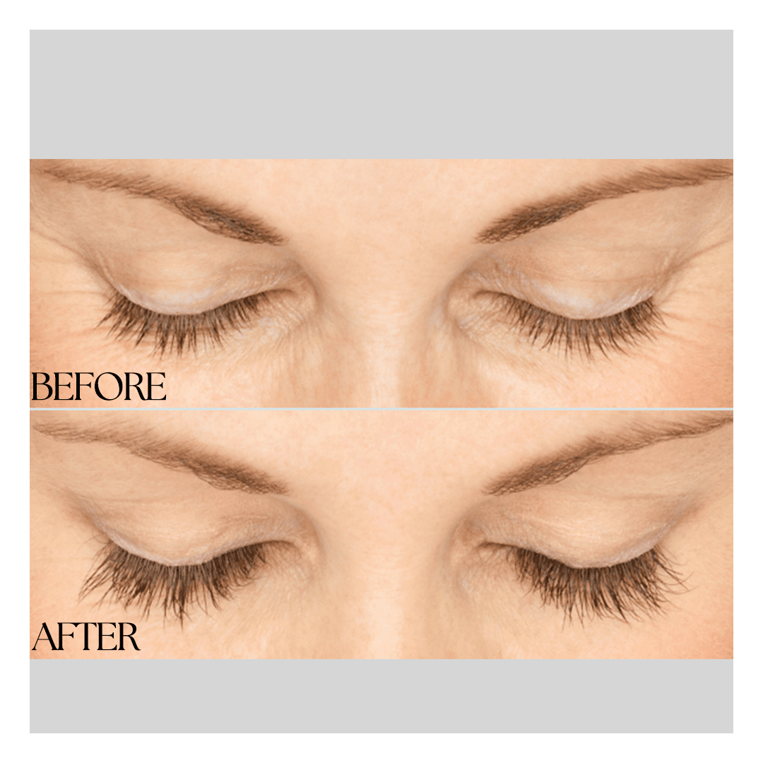 New Medical Spa result — Glen Allen, VA