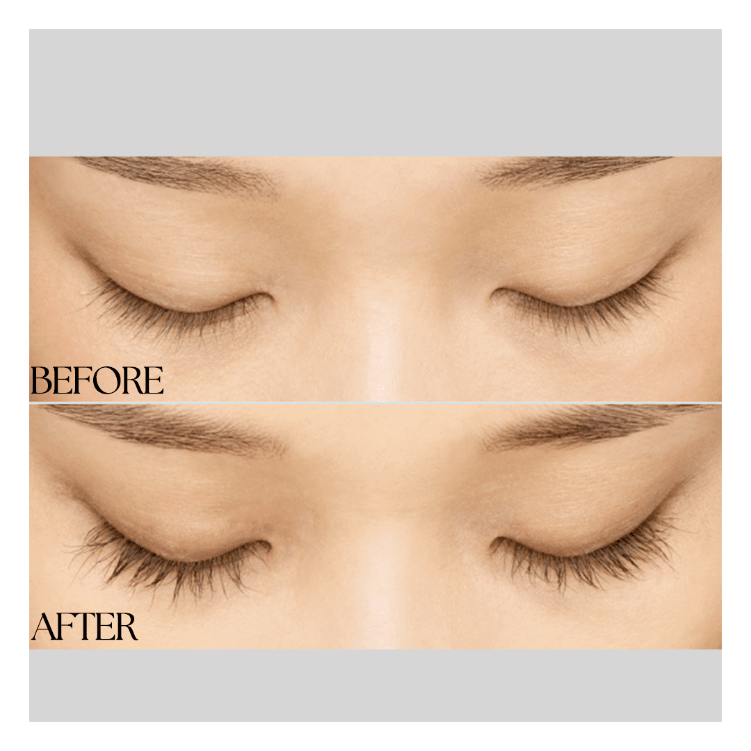 New Medical Spa result — Glen Allen, VA