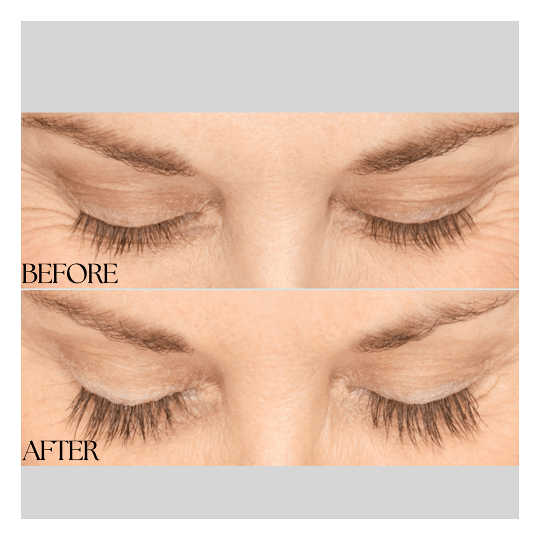 New Medical Spa result — Glen Allen, VA