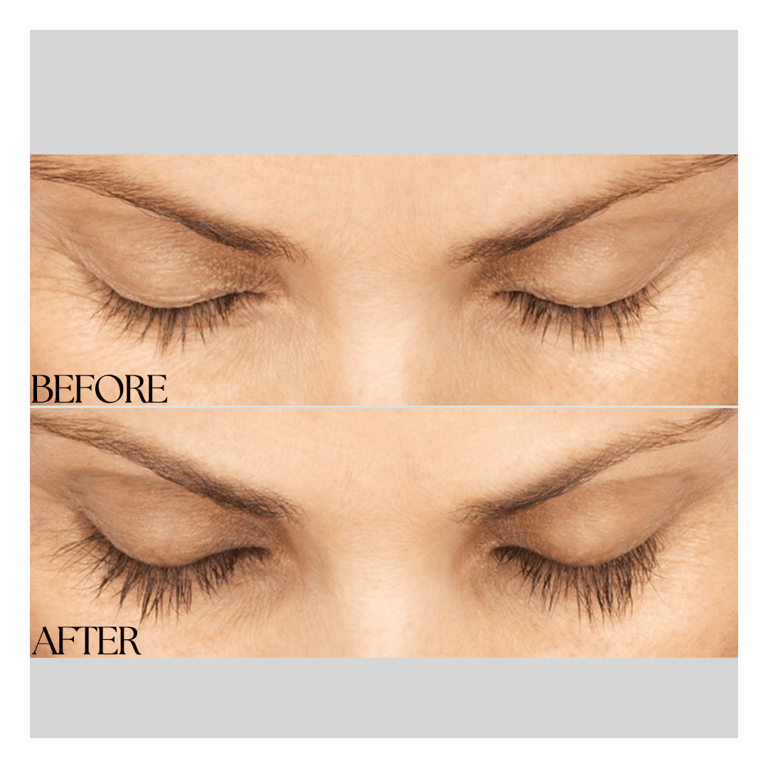 New Medical Spa result — Glen Allen, VA