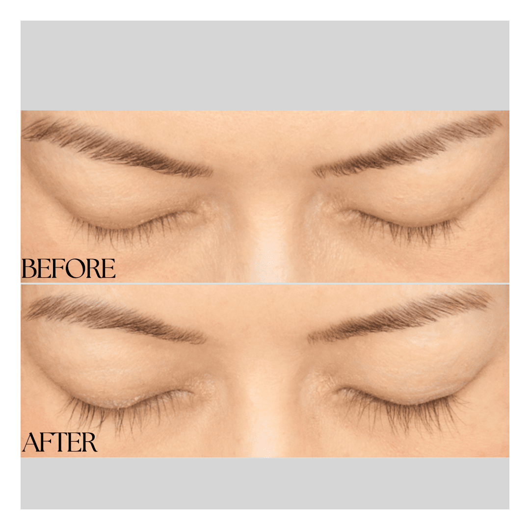 New Medical Spa result — Glen Allen, VA