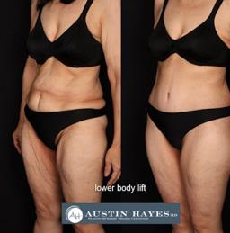 Austin Hayes, MD logo