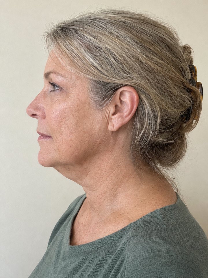 Left profile
